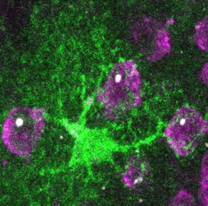 Huntington's disease: astrocytes to the rescue!