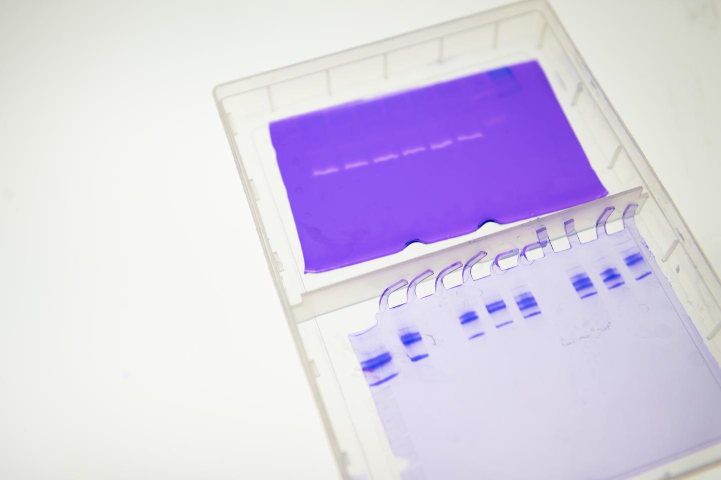 Cathepsin Activity in Lab Samples