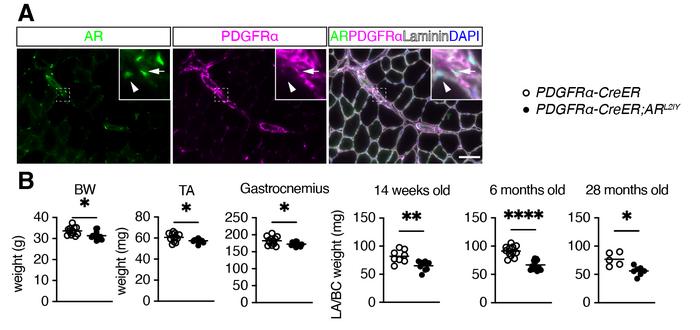 【Figure1】AR-deficient mice in mesenchymal progenitors