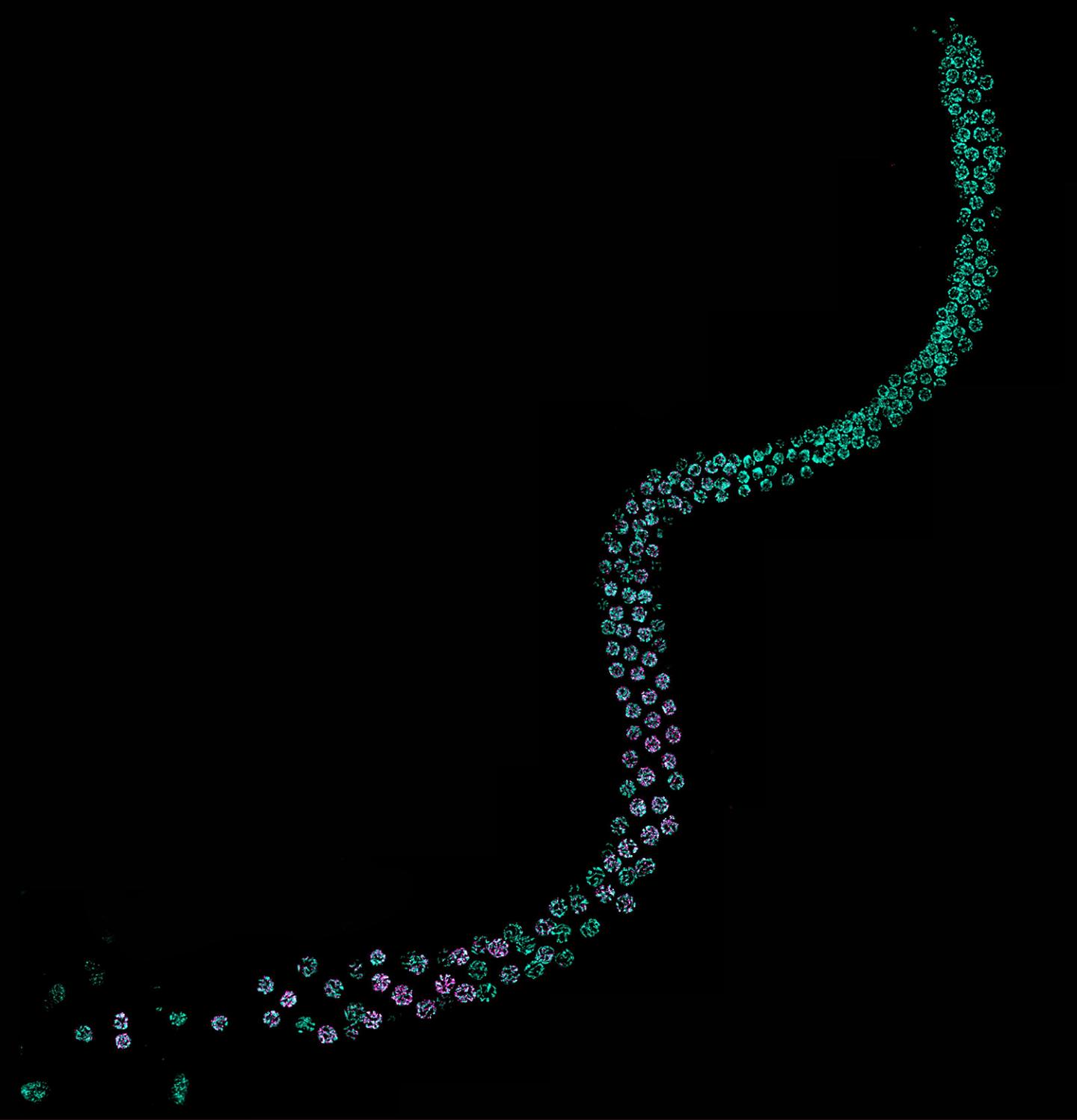 DNA damage in male germline