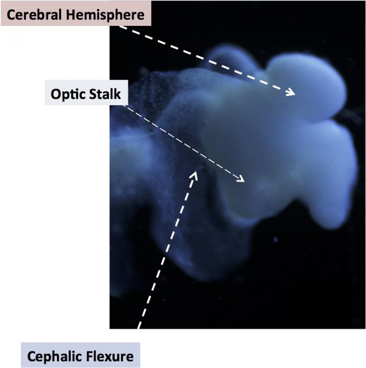 Brain Organoid