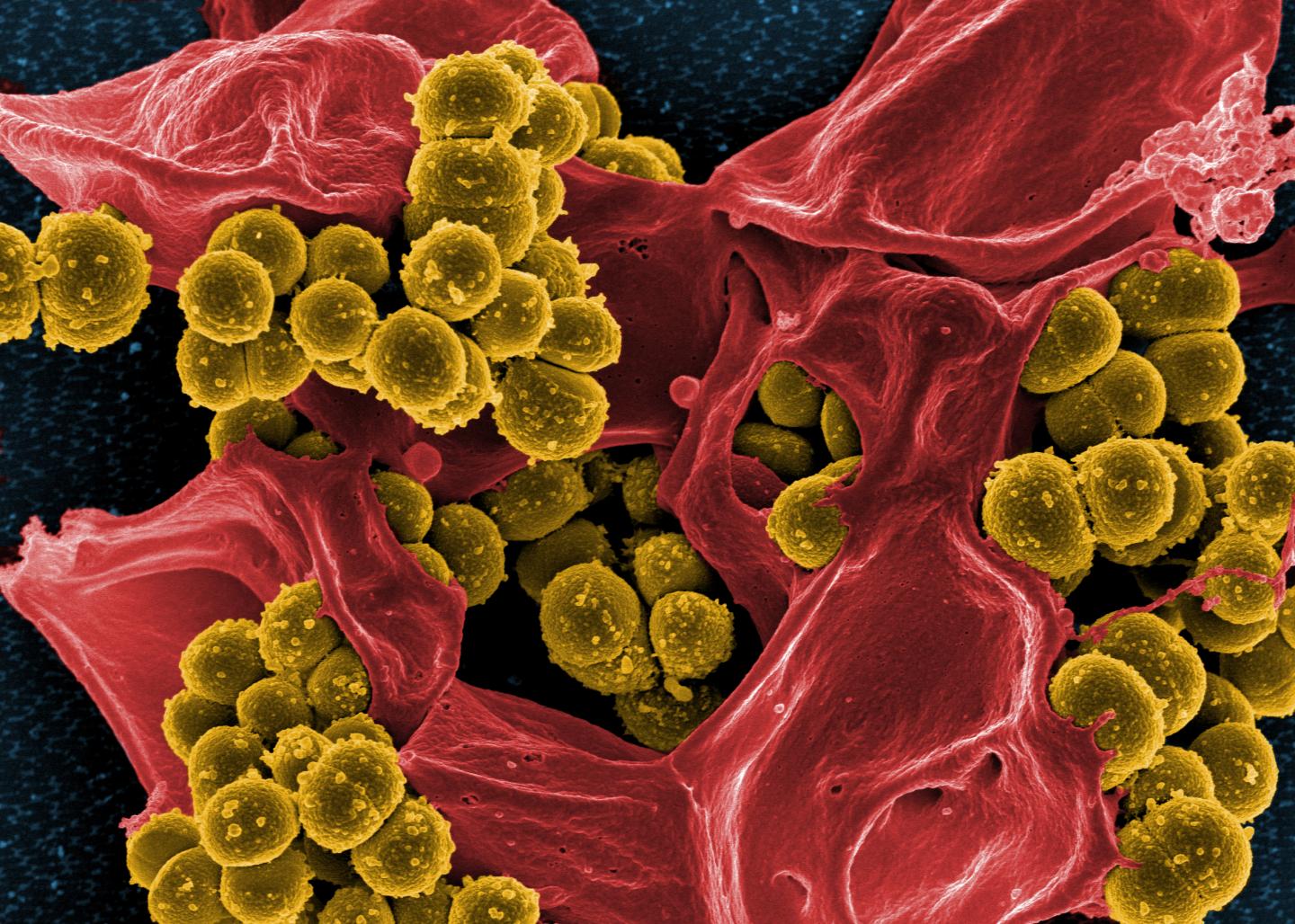 Staphylococcus aureaus