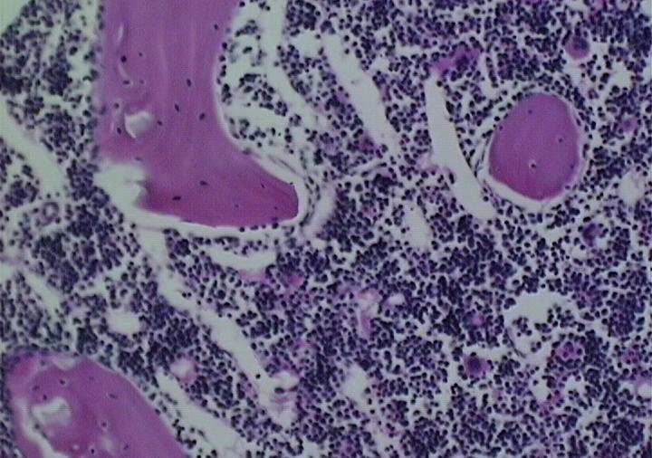 Marrow (2 of 2) [IMAGE] | EurekAlert! Science News Releases