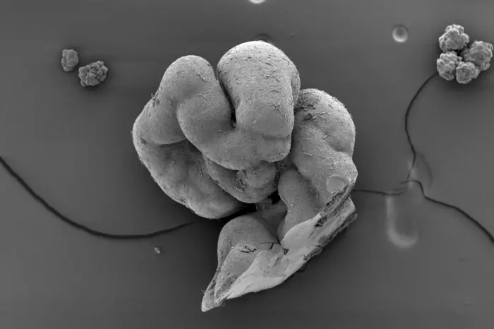 Electron scanning microscopy image (2) showing a very detailed look at pieces of trunk organoids. (Tiago Rito, Marie-Charlotte Domart)