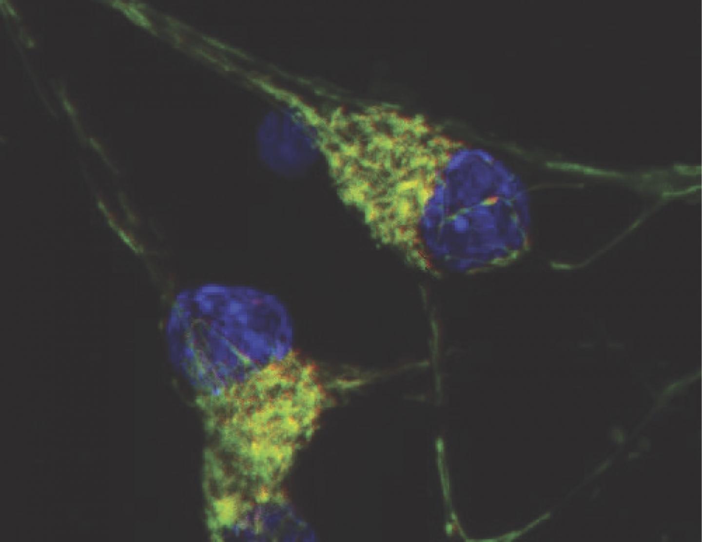 Impaired Recycling of Mitochondria