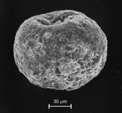Iberulite Observed with an Electronic Microscope (SEM)