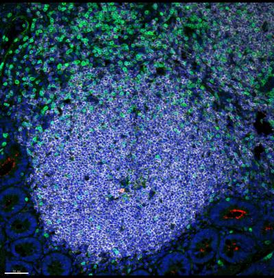 HIV lymphoid follicles