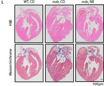 Metabolite Protects Mice Against Muscle Wasting