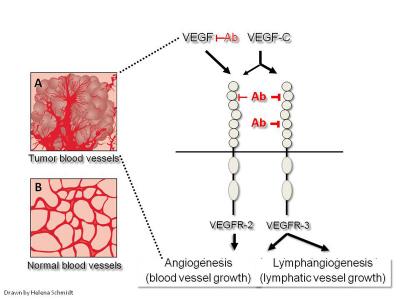 A Double Block of Blood Vessels