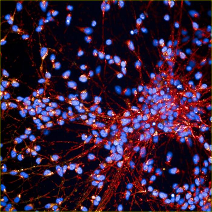 Cortical nerve cells generated from patients' stem cells