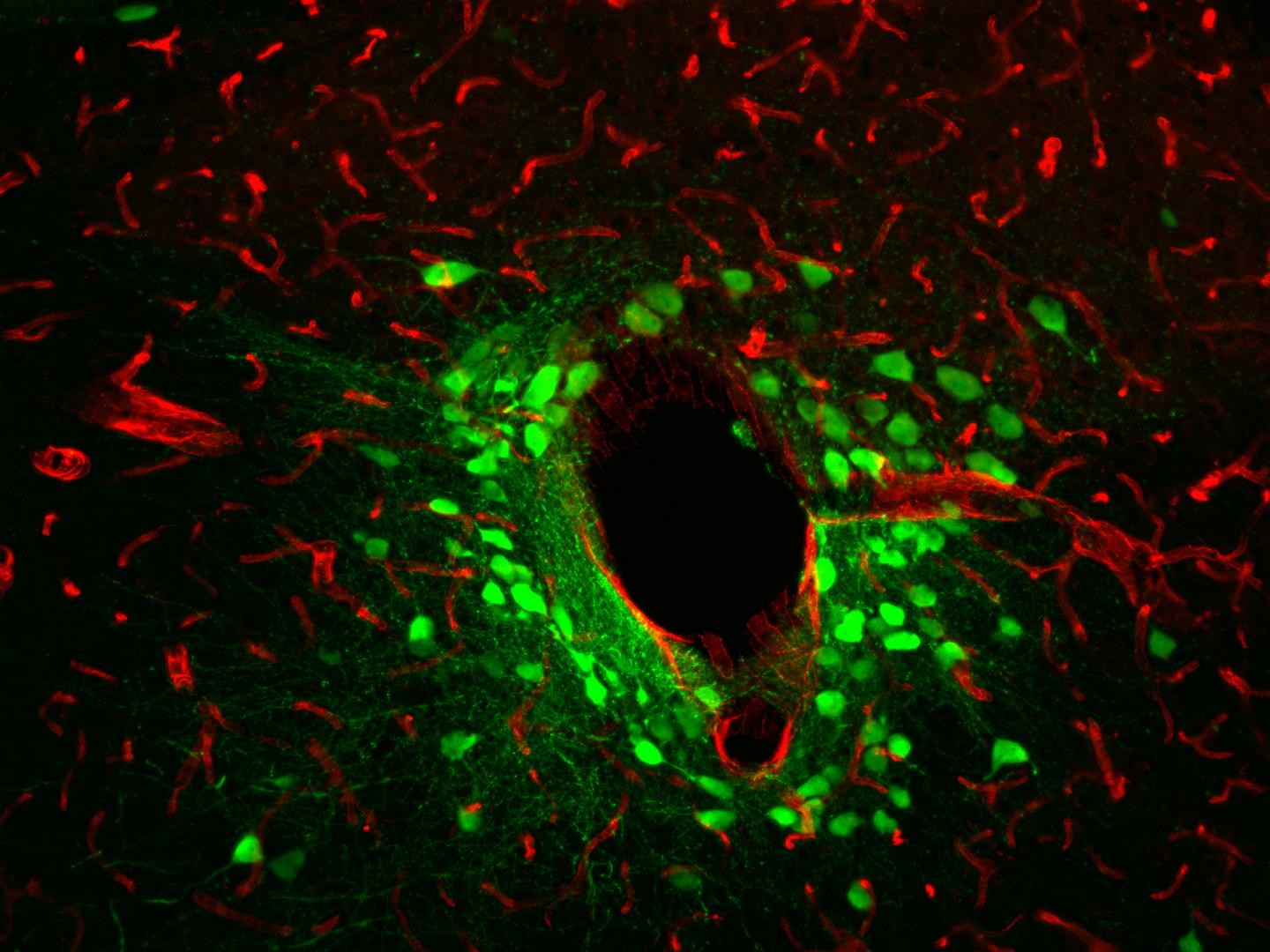 Physical Positioning Dramatically Enhances Brain Transduction After Intrathecal AAV9 Infusion (3-7)