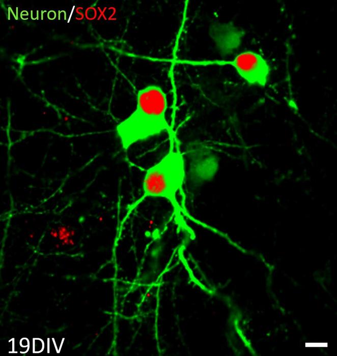 University of Barcelona team rejuvenates brain neurons through cellular reprogramming: more neurons and more brain plasticity