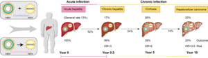 Schematic diagram of hepatitis D virus (HDV) infection patterns, disease progression, and outcomes