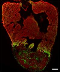 Activity of a Glycolytic Transporter in the Border Zone of the Zebrafish Heart
