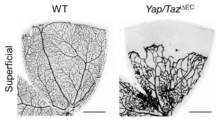 Vasculature in the Retina With (right) and Without (left) YAP/TAZ