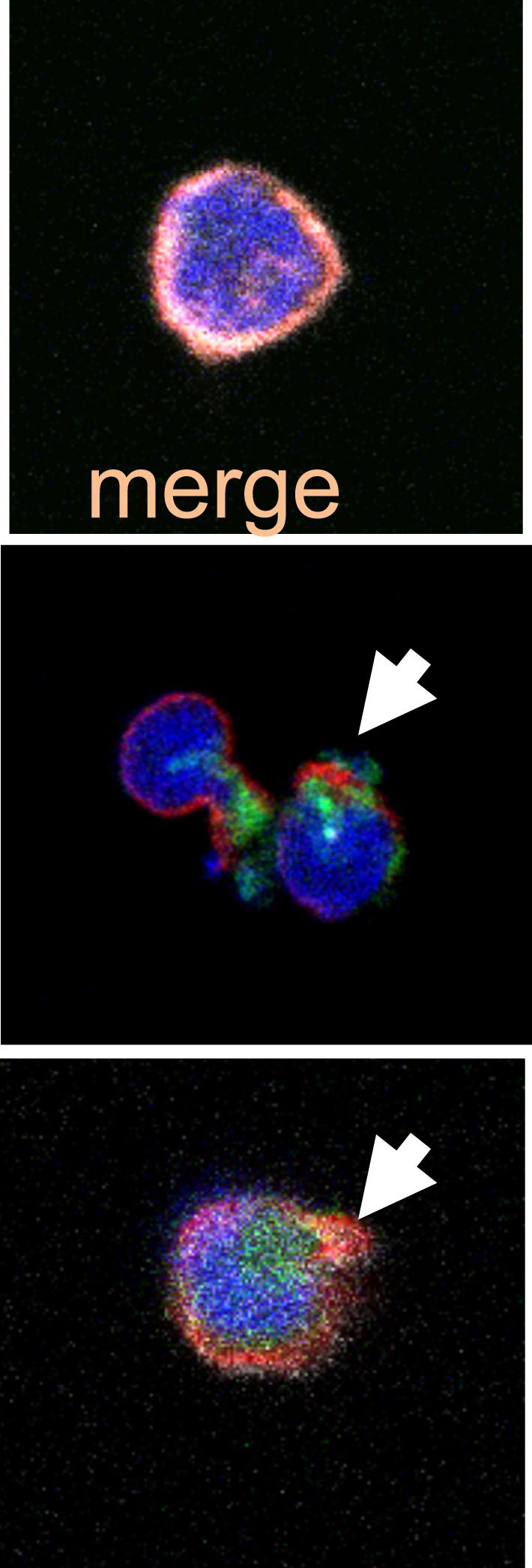 Understanding Defective T Cell Function in Multiple Sclerosis (1 of 1)