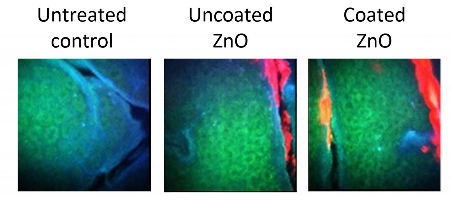 Realistic Exposure Study Supports the Use of Zinc Oxide Nanoparticle Sunscreens