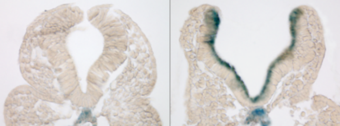 Mothers’ Diabetes Induces Premature Aging of Neural Tissue In Mice