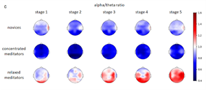 Changes in the electrical activity of the brain in participants of the experiment