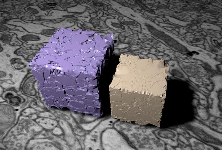 Models of Brain Cryofixation (Purple) Vs Chemical Fixation (Brown)