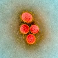 SARS-CoV-2 Virus Particles