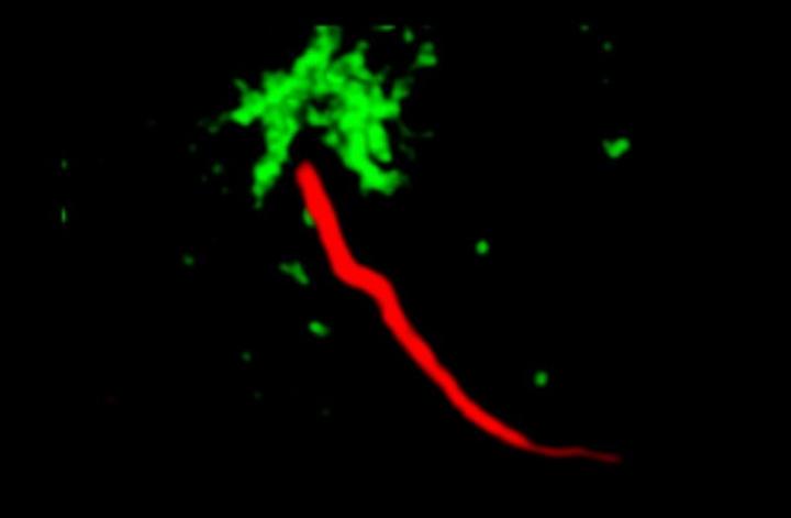 Closeup of Primary Cilia in Human Cartilage Cells