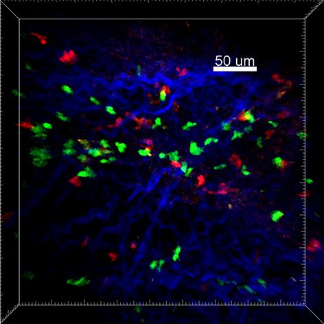 Regulatory T cells with Th17 cells