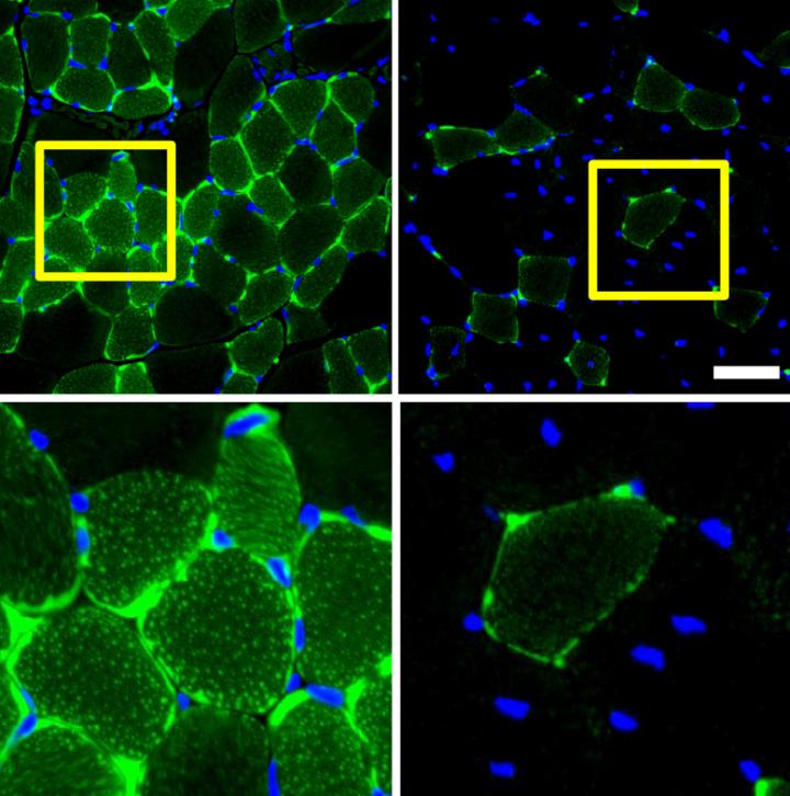 Female Mice Have a Unique Metabolic Mechanism to Adapt to Fasting (1 of 1)