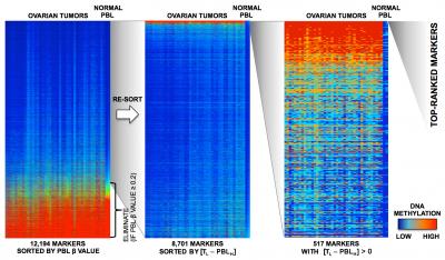 Unique Fenetic Marker May Improve Detection of Recurrent Ovarian Cancer