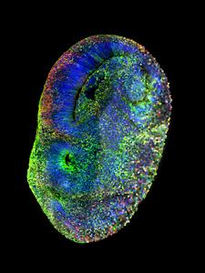 Microscopy image and artistic representation of the CHOOSE system in a human brain organoid.