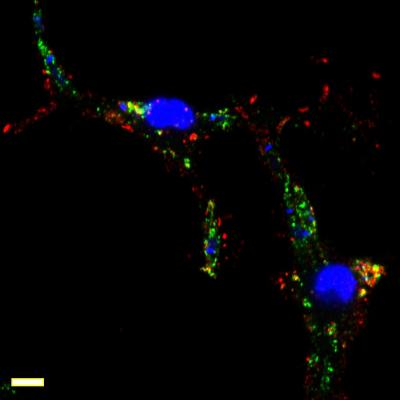 Redistribution of Leishmania Virulence Factors