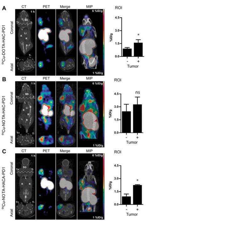 Human PD-L1 Immune Checkpoint Imaging using Cu-64