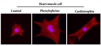 Heart Muscle Cells 