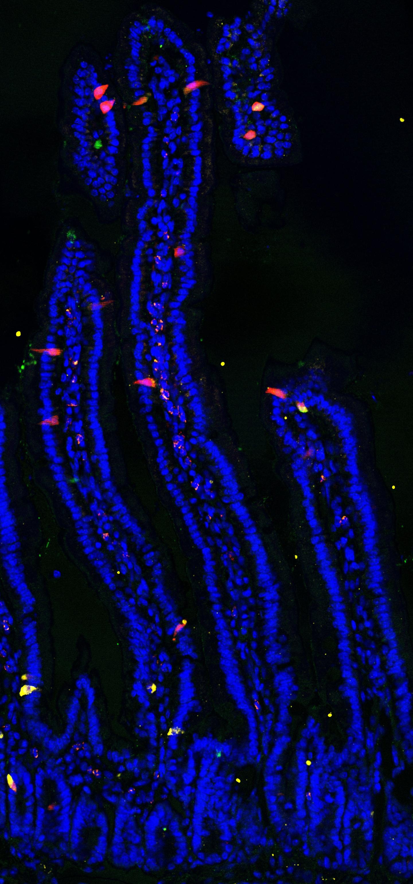 Enteroendocrine Cells in the Mouse Intestine (1 of 2)