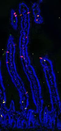 Enteroendocrine Cells in the Mouse Intestine (1 of 2)