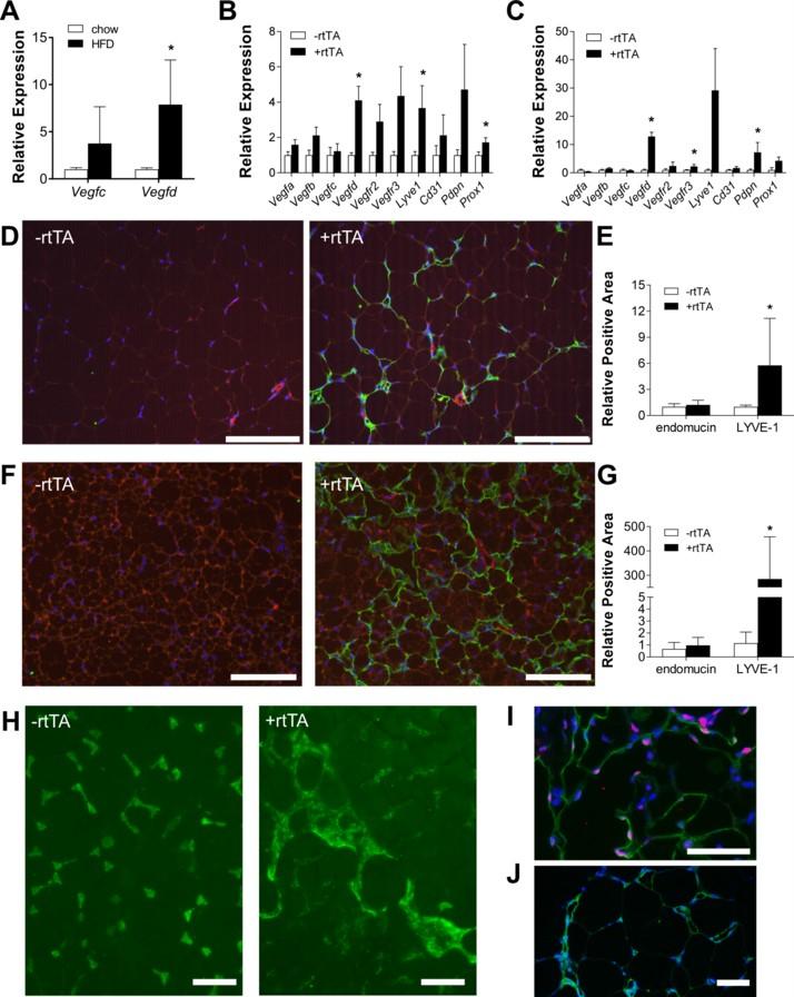 Mobilizing The Lymphatic System May Help Combat Obesity-Induced Metabolic Syndrome