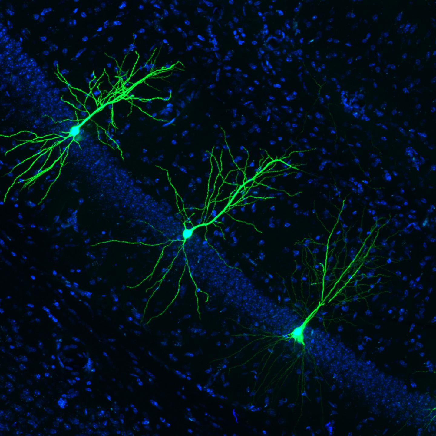 Maintaining Healthy Dendritic Spines