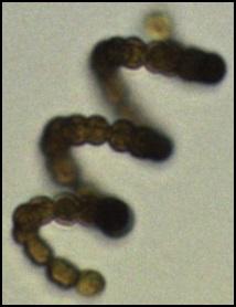Anabaena