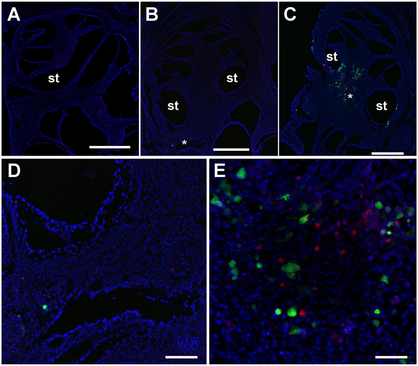 Immune System Cells Protect Against CMV-Induced Hearing Loss in Mice