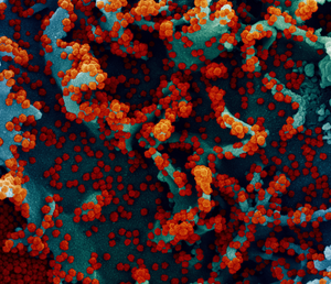 Colorized scanning electron micrograph of a cell infected with SARS-CoV-2