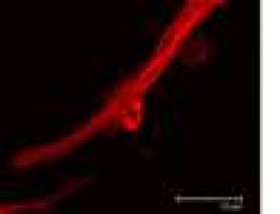 Rho-associated Protein Kinase-regulated Microtubule