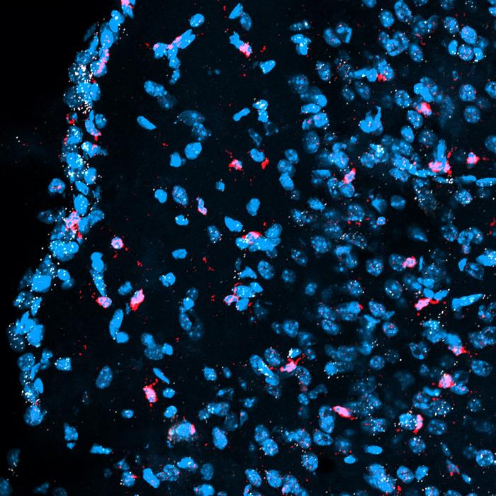 Microglia in a mouse brain