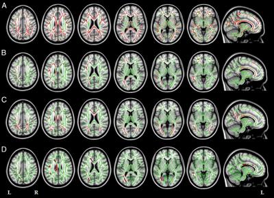 Fractional Anisotropy Results