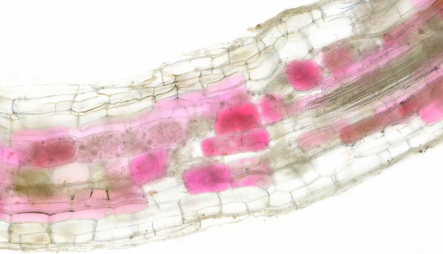 Cells of roots colonised by fungi turn red (2)