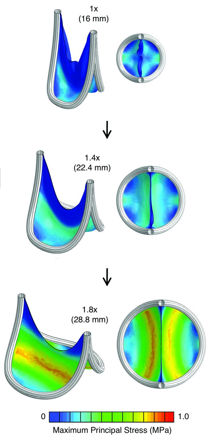 Size-Adjustable Prosthetic Heart Valve Accommodates Heart Growth in Sheep (1 of 8)