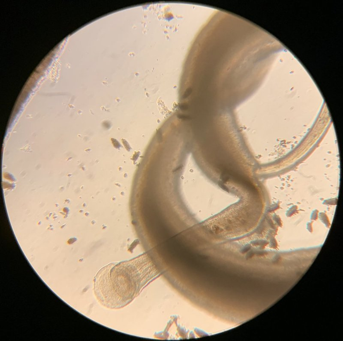 A pair of schistosomes in culture surrounded by eggs recently laid by the female