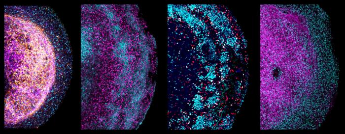 Brain organoid - moon