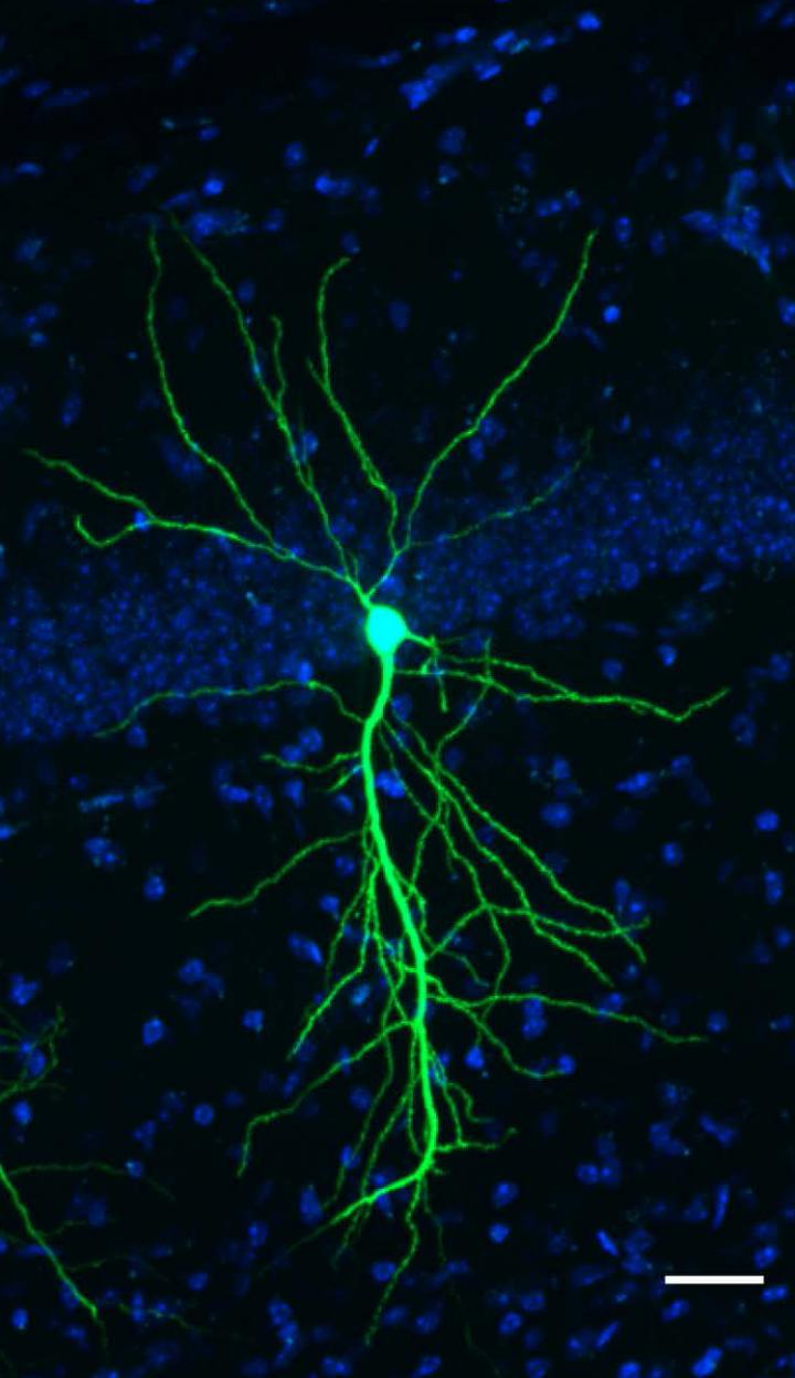 A Cancer Drug Candidate Protects Neurons Against Alzheimer's in Mice (1 of 1)