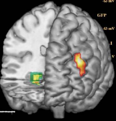 Brain Areas Where Activity Differed by Gene Type
