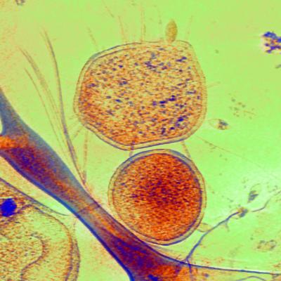 Microbe Interactions